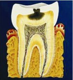 Boli ale dinților, gingiilor și remedii populare pentru durere de dinți, sănătate și longevitate regula (medicament pe bază de plante) dentare boli ale gingiilor și remedii populare pentru reguli dureri de dinți, sănătate și longevitate