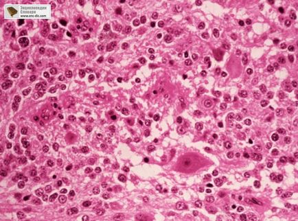 Retroperitoneum - etsiklopediya medicale - Enciclopedia & amp; dicționare (spațiu) Retroperitoneum - etsiklopediya medicale - Enciclopedia & amp; dicționare