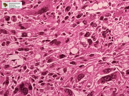 Retroperitoneum - etsiklopediya medicale - Enciclopedia & amp; dicționare (etsiklopediya medicale) Retroperitoneum - etsiklopediya medicale - Enciclopedia & amp; dicționare