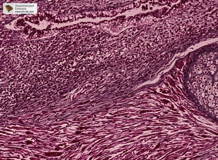 Retroperitoneum - etsiklopediya medicale - Enciclopedia & amp; dicționare (unele tumori retroperitoneale) Retroperitoneum - etsiklopediya medicale - Enciclopedia & amp; dicționare