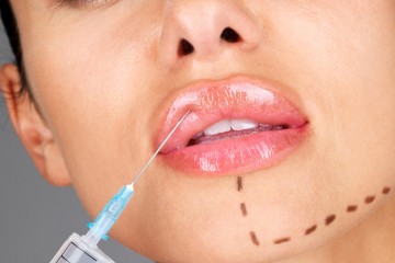 ridurile de umplere acid hialuronic (acid) Completarea ridurilor cu acid hialuronic