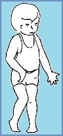 accident vascular cerebral copil (accident vascular cerebral) accident vascular cerebral pentru copii