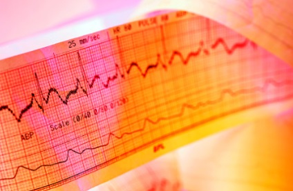ECG cu o sarcină de încărcare - în Krasnoyarsk cu ultrasunete (poate încărca Krasnoyarsk) ECG cu o sarcină de încărcare - ultrasunetelor în Krasnoyarsk