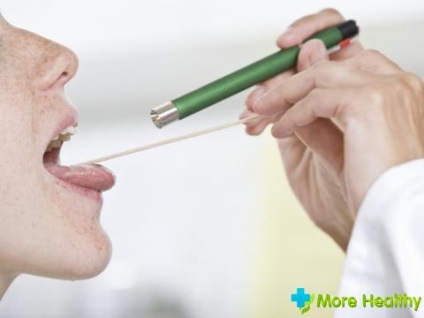 Inflamarea limbii în tratamentul gât conservator și metodele tradiționale