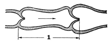 Sistemul limfatic (limfatic capilar limfatic) Sistemul limfatic
