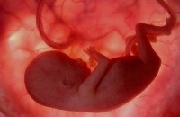 Desprinderea placentară (desprindere simptome principale) mazolysis