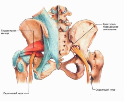 Simptomele sindromului piriformis si tratament