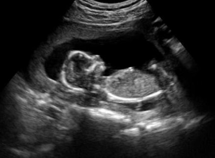 Uzi in timpul sarcinii, prețul la București, face cu ultrasunete pentru sarcină
