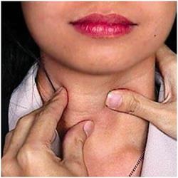 Възлите в симптомите на щитовидната и ефекти