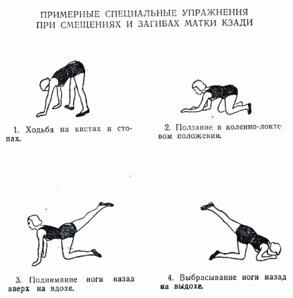 Curbura a uterului și concepția - care reprezintă ajutor pentru a ramane insarcinata