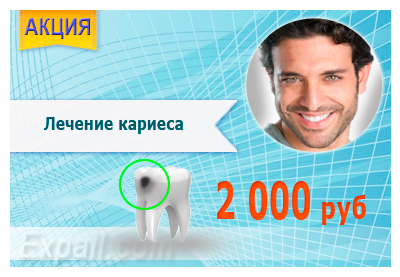 Біметалічні коронки склад, переваги, вартість (переваги) Біметалічні коронки склад, переваги, вартість