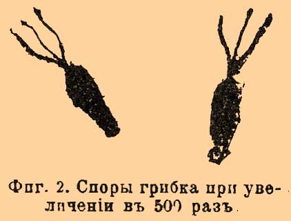 Чайні хвороби - це (рослин 1902 Спішно) Чайні хвороби - це