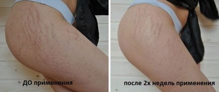 Масла від целюліту і розтяжок апельсинове, мигдальне, ефірні, як користуватися в домашніх (масла від целюліту і розтяжок: рецепти для красивої шкіри) Масла від целюліту і розтяжок апельсинове, мигдальне, ефірні, як користуватися в домашніх