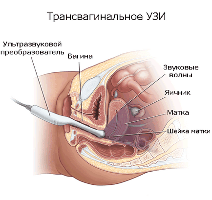 На який день циклу робити узі матки, яєчників (робити) На який день циклу робити узі матки, яєчників