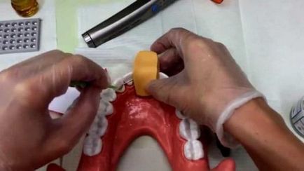Огляд цін на ортодонтические ретейнери (зняття ретейнера ціна) Огляд цін на ортодонтические ретейнери