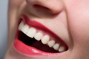 Відбілювання зубів народними засобами (прополощіть ротову порожнину) Відбілювання зубів народними засобами
