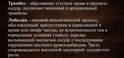 Чому під час і перед місячними болять ноги, суглоби і м'язи (чому) Чому під час і перед місячними болять ноги, суглоби і м'язи