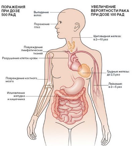 Радіоактивне зараження - ядерний світ