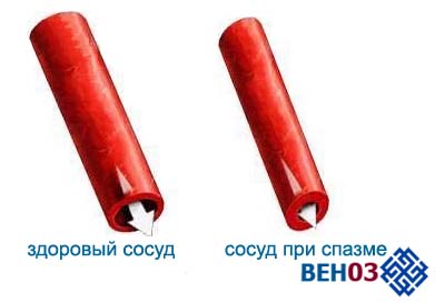 Спазм периферичних судин при гіпертонії - новини медицини (гіпертонія лікування ростіть препарат) Спазм периферичних судин при гіпертонії - новини медицини