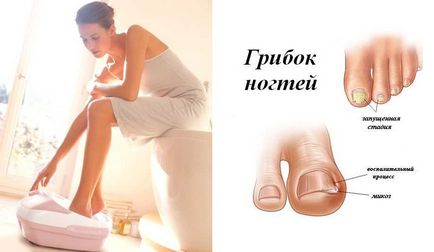 Ванночка для ніг при грибку нігтів - прості і швидкі рецепти лікування від zdravoline (ванночки проти грибка) Ванночка для ніг при грибку нігтів - прості і швидкі рецепти лікування від zdravoline