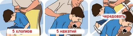 Ось що радять робити лікарі, якщо ваша дитина раптово вдавився або поперхнувся, ця інформація (дитина) Ось що радять робити лікарі, якщо ваша дитина раптово вдавився або поперхнувся, ця інформація