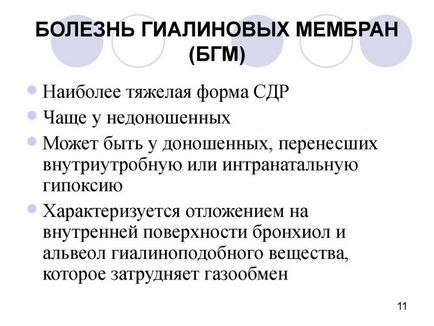 Хвороба гіалінових мембран - що таке, симптоми, лікування, причини, прогноз, результат