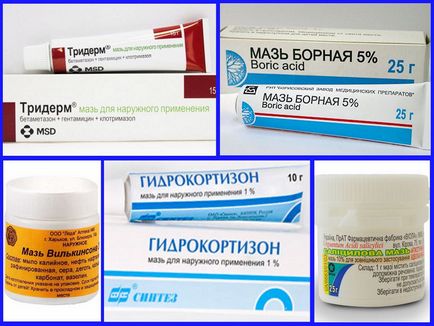 Екзема на ногах (Комплексне лікування екземи) Екзема на ногах