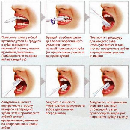 Як правильно чистити зуби