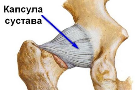 Розтягнення зв'язок тазостегнового суглоба, симптоми і лікування