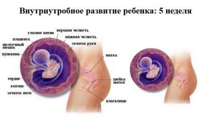 Узі 1 триместру розшифровка, норма узі вагітності на ранніх термінах, перше узі