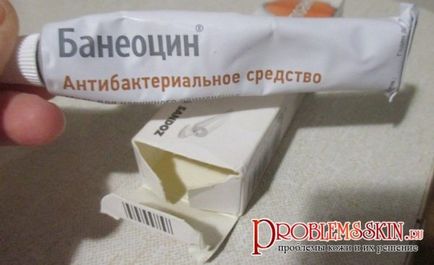 Банеоцин від - болючих, підшкірних прищів на обличчі, відгук олени