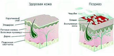 Шкірні захворювання на ногах і лікування народними засобами