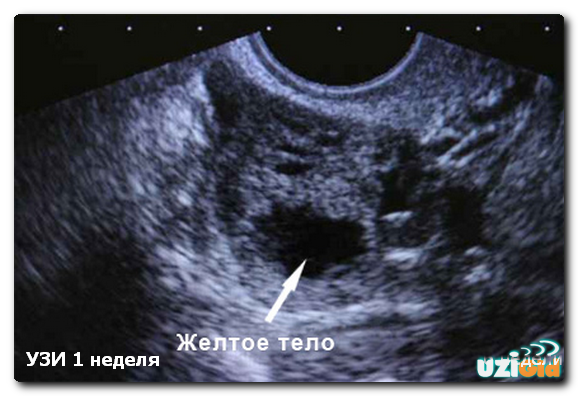Узі на 1, 2, 3 тижні вагітності; покаже чи узі, фото