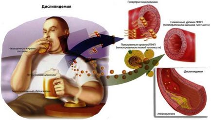 Алкоголь і холестерин зв'язок і вплив