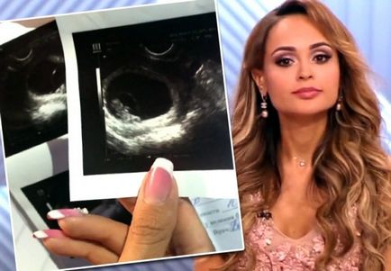 Анна Калашникова втратила дитину що про це відомо (співачка) Анна Калашникова втратила дитину що про це відомо