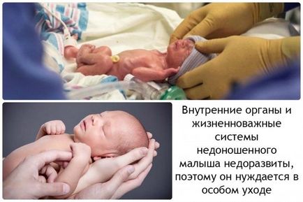 Як здійснювати догляд за недоношеною дитиною, його особливості відео