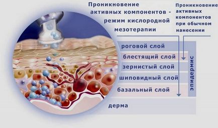 Киснева мезотерапія особи ефективність, показання, наслідки