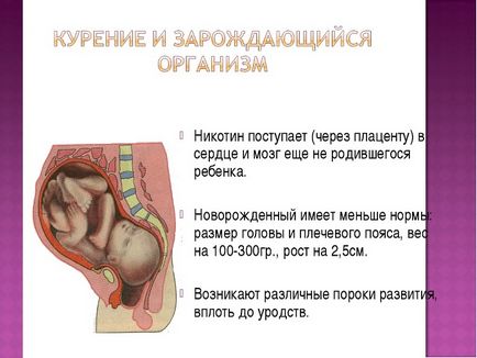 Куріння під час вагітності наслідки, ніж небезпечно, загрожує, до чого призводить, для дитини