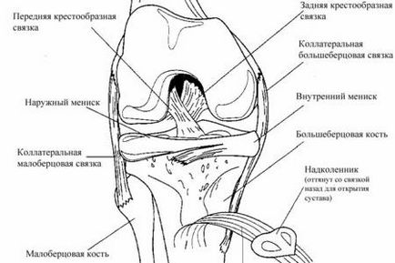 Надрив зв'язок колінного суглоба лікування і симптоми