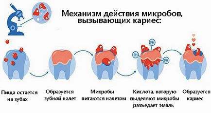 Харчування і карієс - корисні і шкідливі продукти, дієта при карієсі - стоматологічний портал