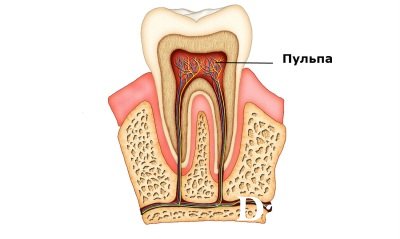 Болить зуб з тимчасовою пломбою що робити, причини і лікування