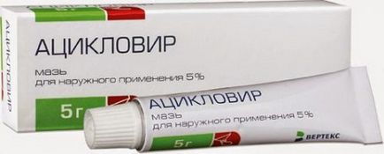 Чим мазати оперізуючий лишай (лишай) Чим мазати оперізуючий лишай