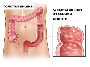 Інструкція по застосуванню сиропу холосас