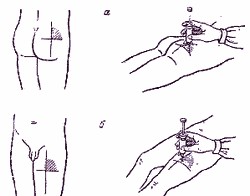 Як робити ін'єкції лежачому хворому - лежачий хворий