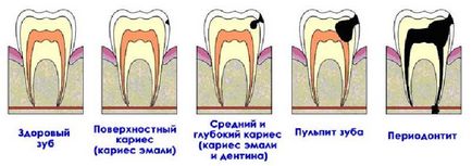 Лікування та реставрація зубів (протезування) Лікування та реставрація зубів
