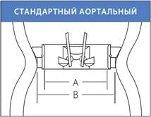 Протез мітрального клапана