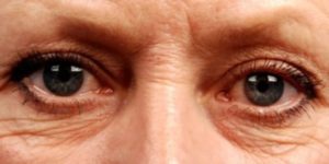 Linie naturală de îngrijire a pielii anti-îmbătrânire chanel ultra corection line repair soin yeux anti rides anti wrinkle ochi crema