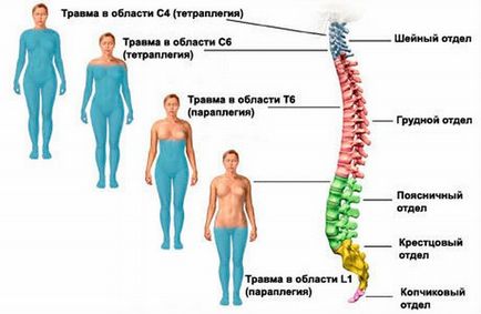 Спинальний шок і механізм його розвитку причини, ознаки, патогенез і фізіологія