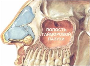 Видалення кісти гайморової пазухи як, навіщо і для чого