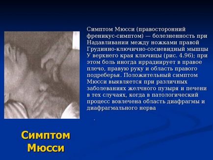 знак Де Мюсе